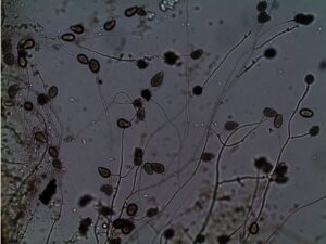 Nam Phytophthora gây hại cho sầu riêng